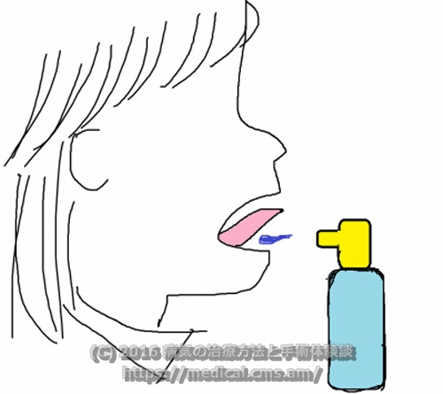 舌下免疫療法