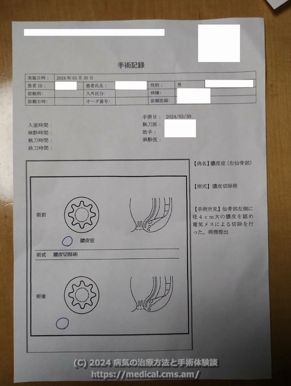 手術記録